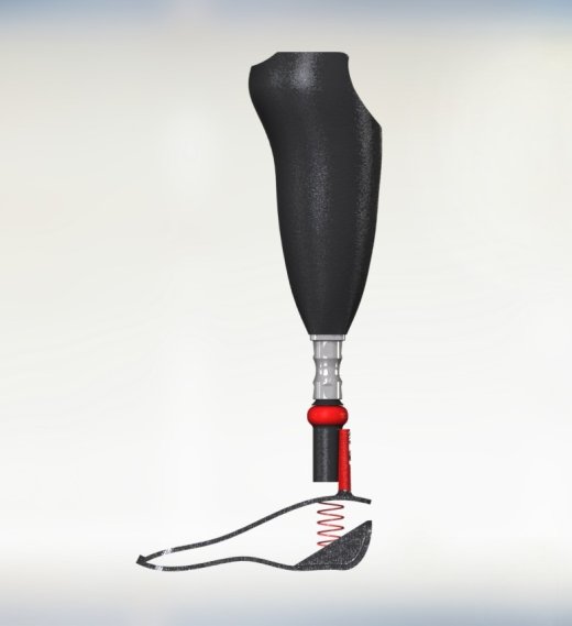 膝关节假体下面缩略图